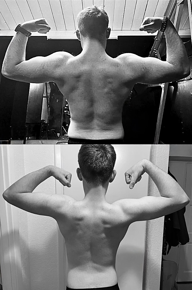 Two client progress photographs arranged vertically.