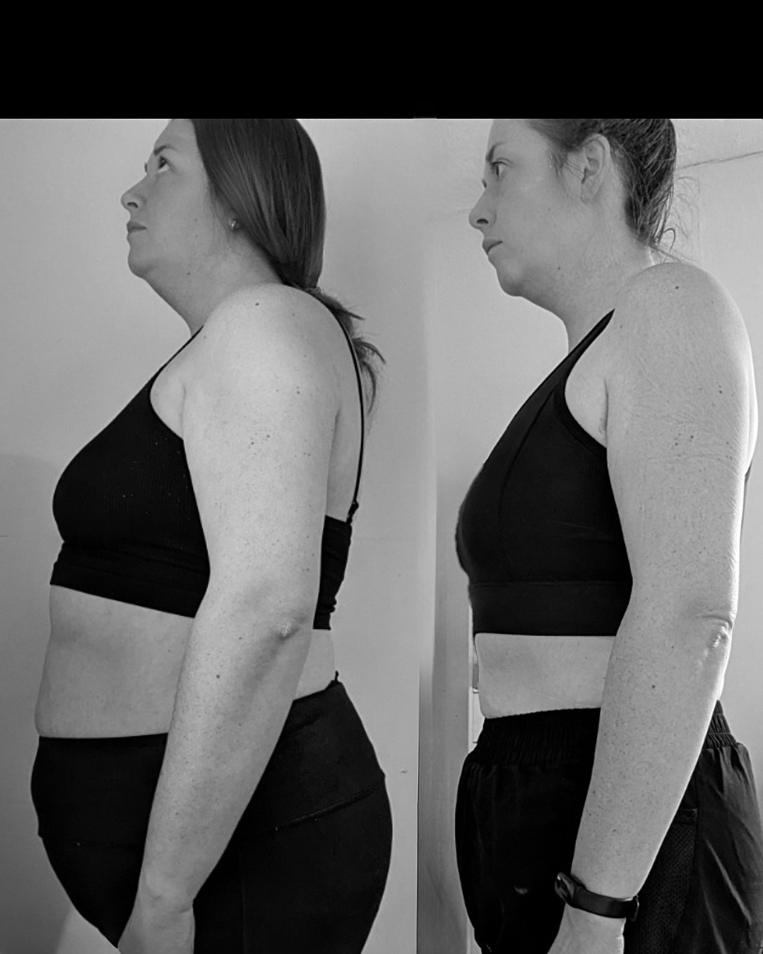 Side-by-side client progress photographs in profile.