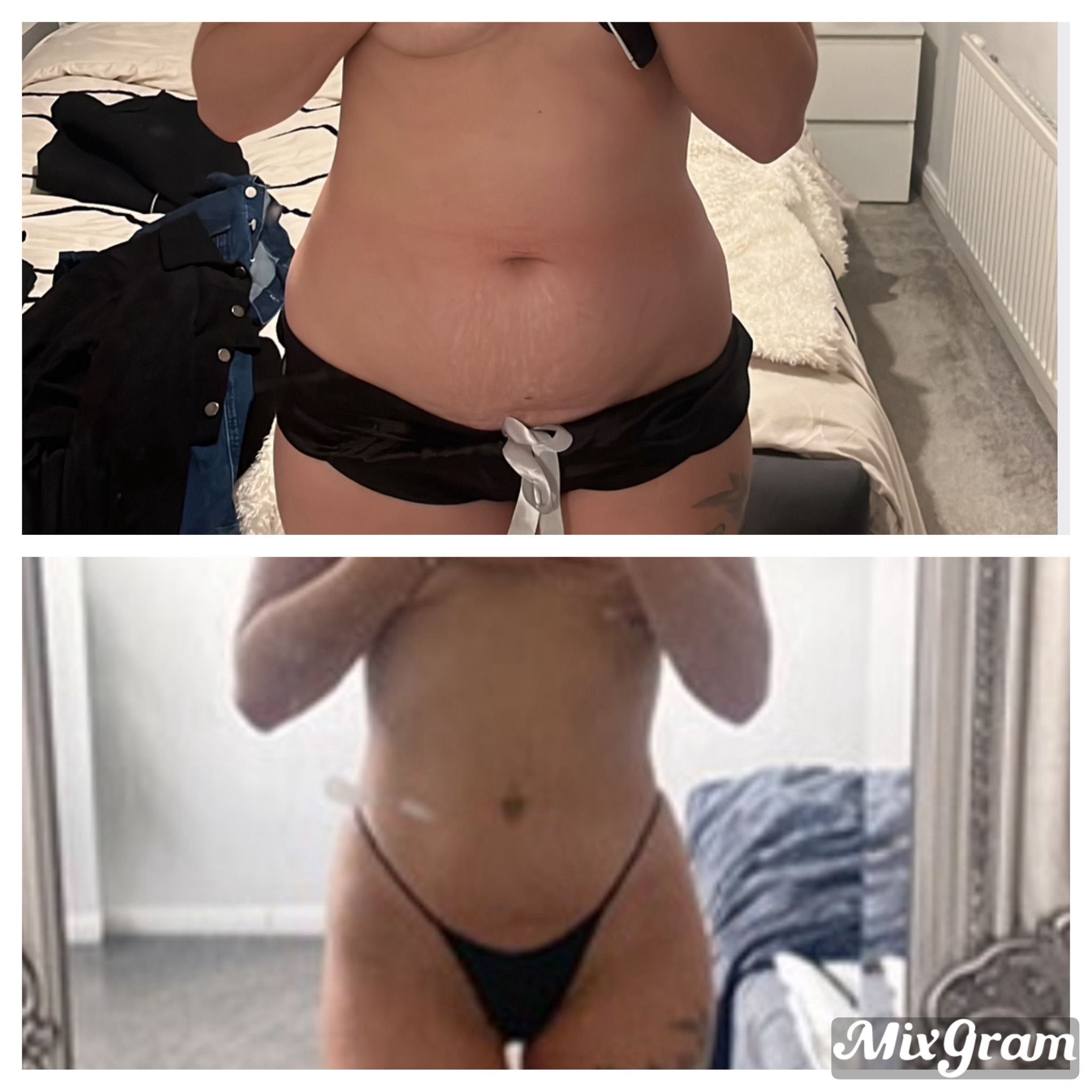 Two client progress photographs arranged vertically.